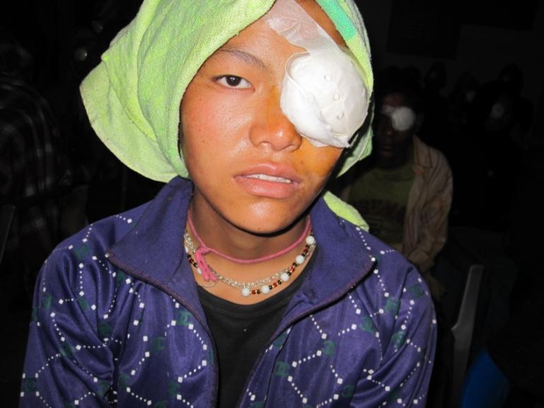Pembi with bandage over her eye