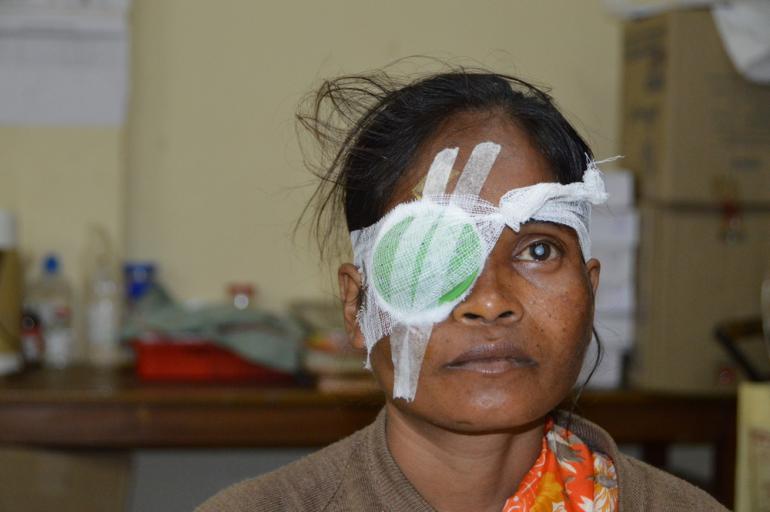 Sabitri with one eye patch