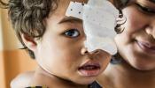 Seva Madagascar 50 years of sight pediatrics