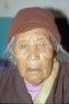 Blind Tibetan woman before cataract surgery