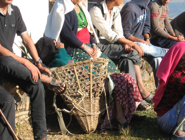 This woman is blind from mature bilateral cataracts and was carried to the Seva eye camp at Terathum by her teenaged grandson in this traditional Nepali basket.