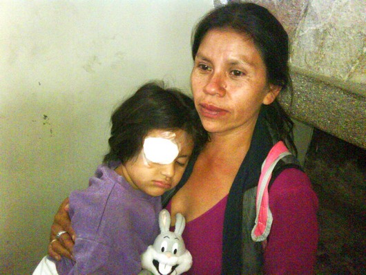 Guatemalan girl Vivian with eye injury