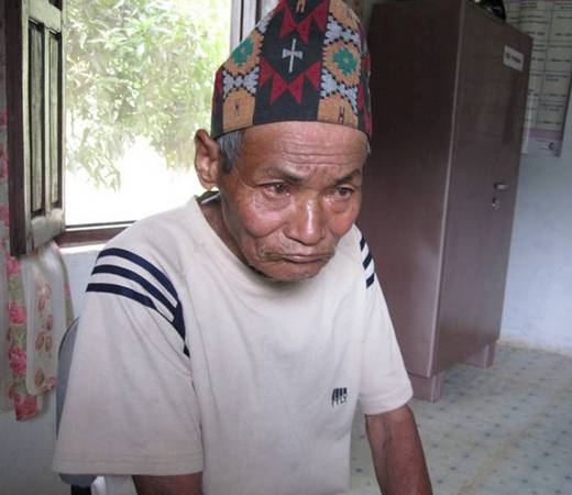 blind Nepali man before cataract surgery