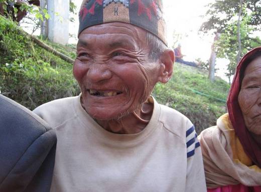 smiling man after cataract surgery