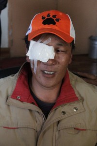 Tibetan nomad after cataract surgery at Seva Tibet eye camp
