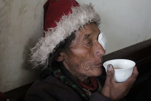 patient after cataract surgery Seva Tibet Nakchu
