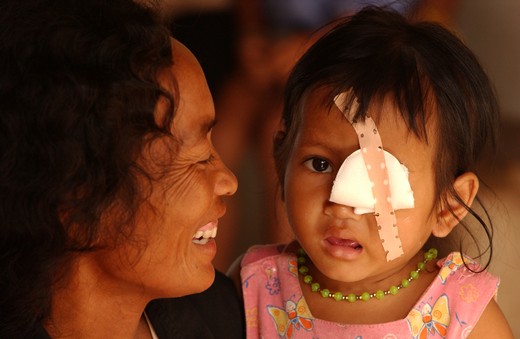 Young Cambodian girl in mother's arms with bandage over left eye
