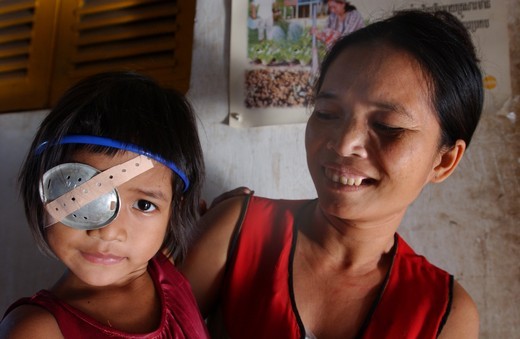 Young cambodian girl with mother post-op with bandage over her right eye